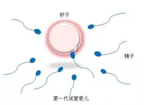 供卵代孕要多少费用
